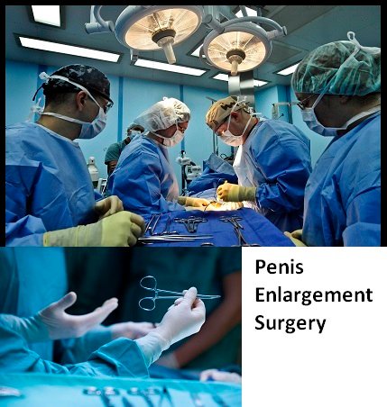 penis enlargement surgery