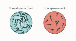 Azoospermia sperm report